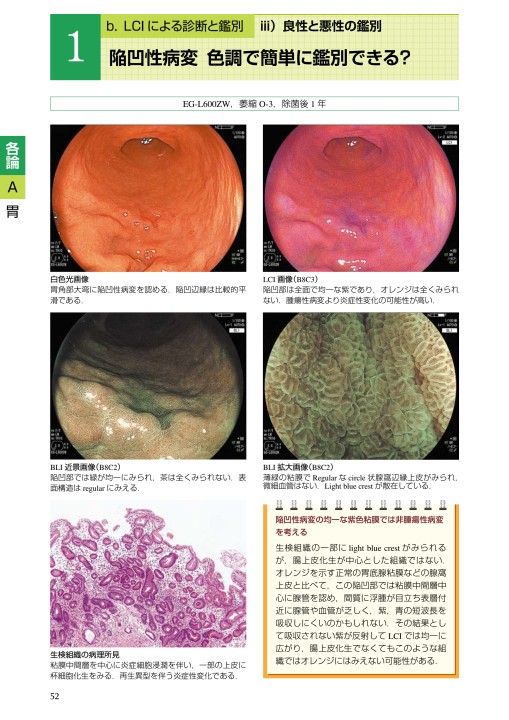 2429Lci内視鏡診断アトラス