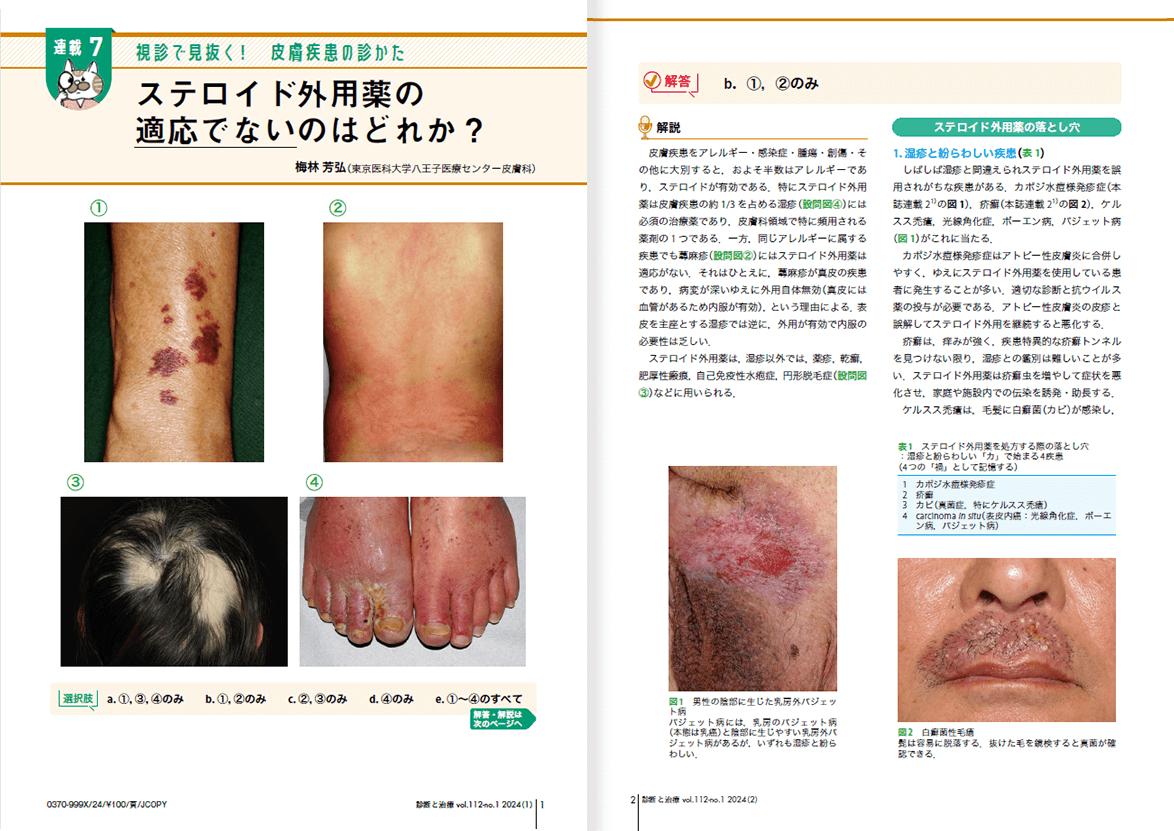 視診で見抜く！ 皮膚疾患の診かた