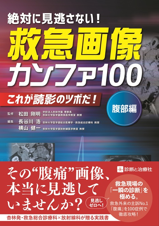 救急画像カンファ100(腹部編) | 診断と治療社