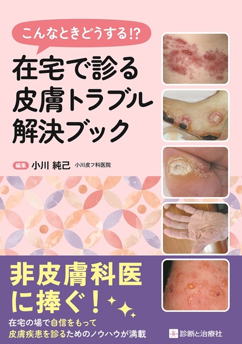 在宅で診る皮膚トラブル解決ブック