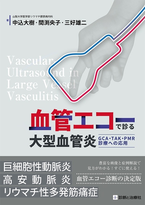 血管エコーで診る大型血管炎