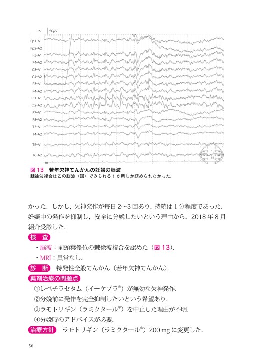 2458一般医のためのベーシックてんかん診療