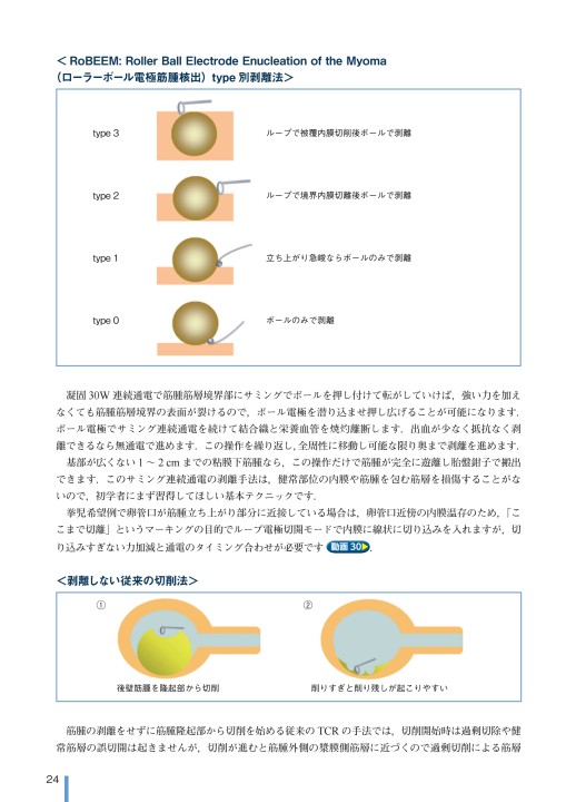 2497動画で学ぶTCR