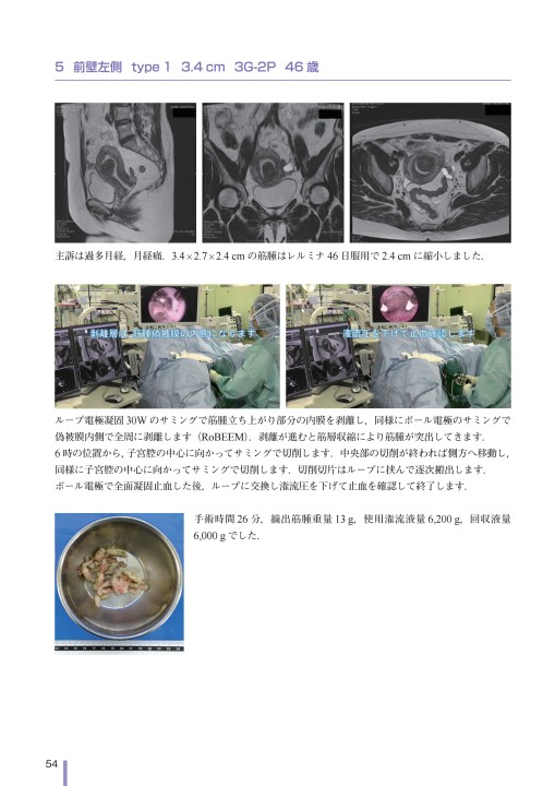 2497動画で学ぶTCR