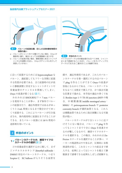 2527脳血管内治療の進歩ブラッシュアップセミナー2021