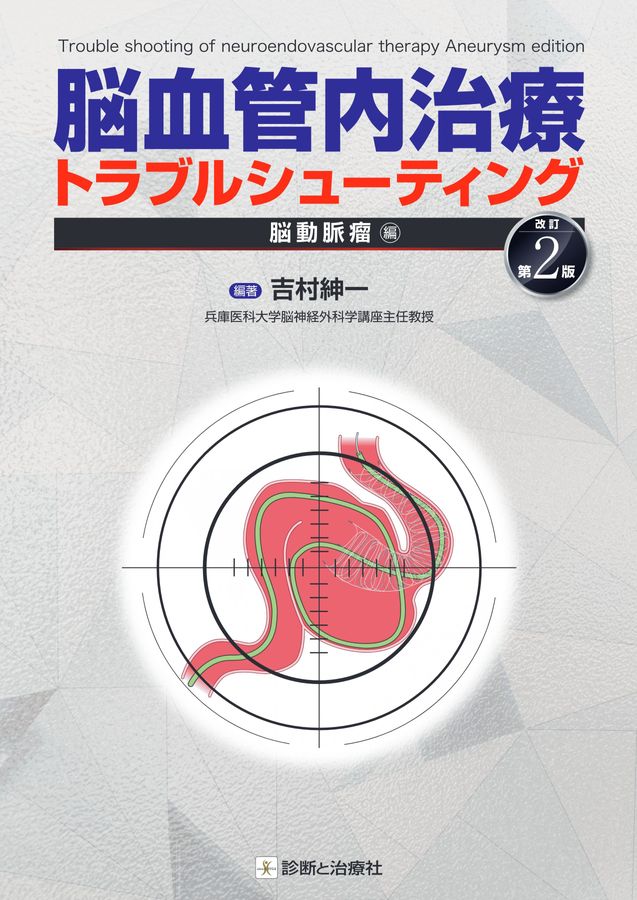 2553脳血管内治療トラブルシューティング 脳動脈瘤編 改訂第2版
