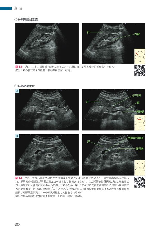 2607 Dr森の腹部超音波診断パーフェクト改訂第2版