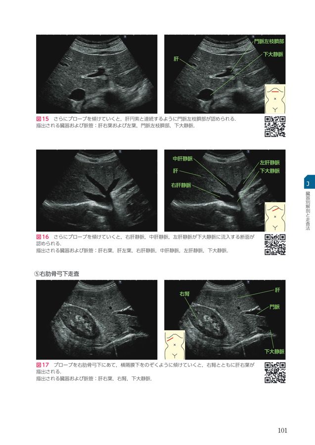 Dr.森の腹部超音波診断パーフェクト 2版 Dr.森の腹部超音波パーフェクト 改訂第2版』刊行記念 Dr.森