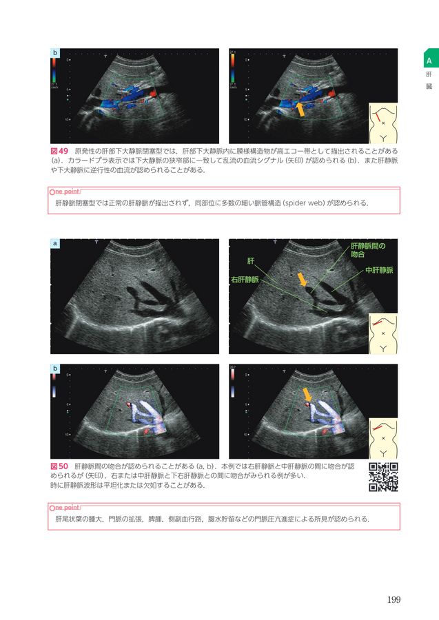 2607 Dr森の腹部超音波診断パーフェクト改訂第2版