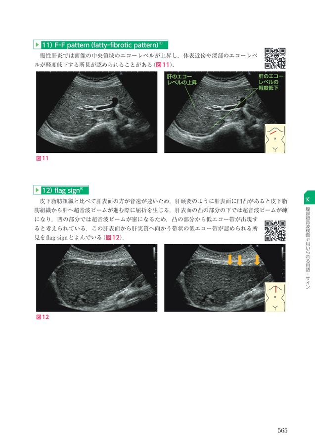 2607 Dr森の腹部超音波診断パーフェクト改訂第2版