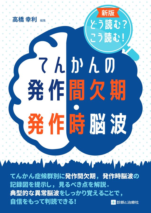 2648新版てんかんの発作間欠期・発作時脳波