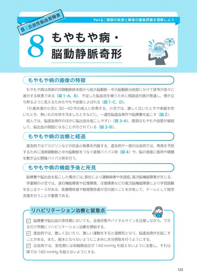 リハビリテーション 評価と治療計画 ICUから始める早期リハビリテーション〜病態にあわせて安全に