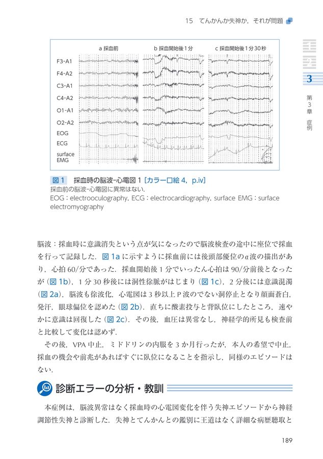 2682小児神経診断エラー学