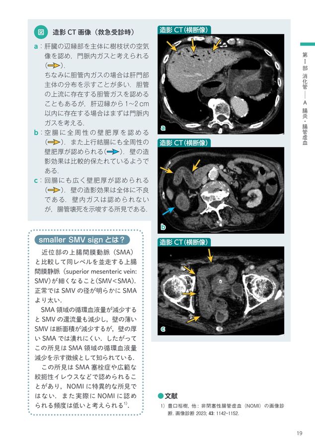 nomi様 【トレイ】1下 2685救急画像カンファ100（腹部編）