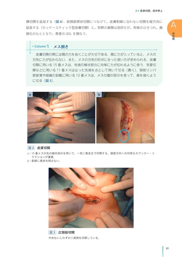2722内分泌外科手術のキホン