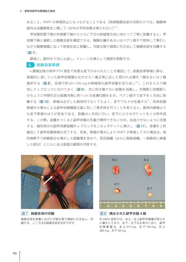 2722内分泌外科手術のキホン